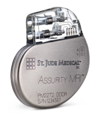 Dual-chamber permanent pacemaker